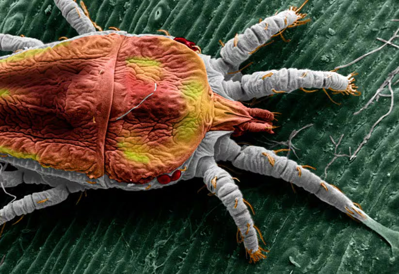 Micrographie électronique d'un faux tétranyque
