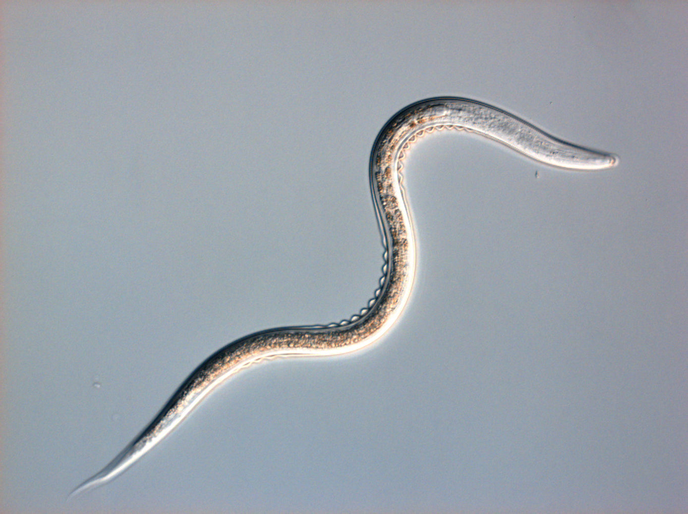 Microscopic view of a worm-like organism on a light gray background