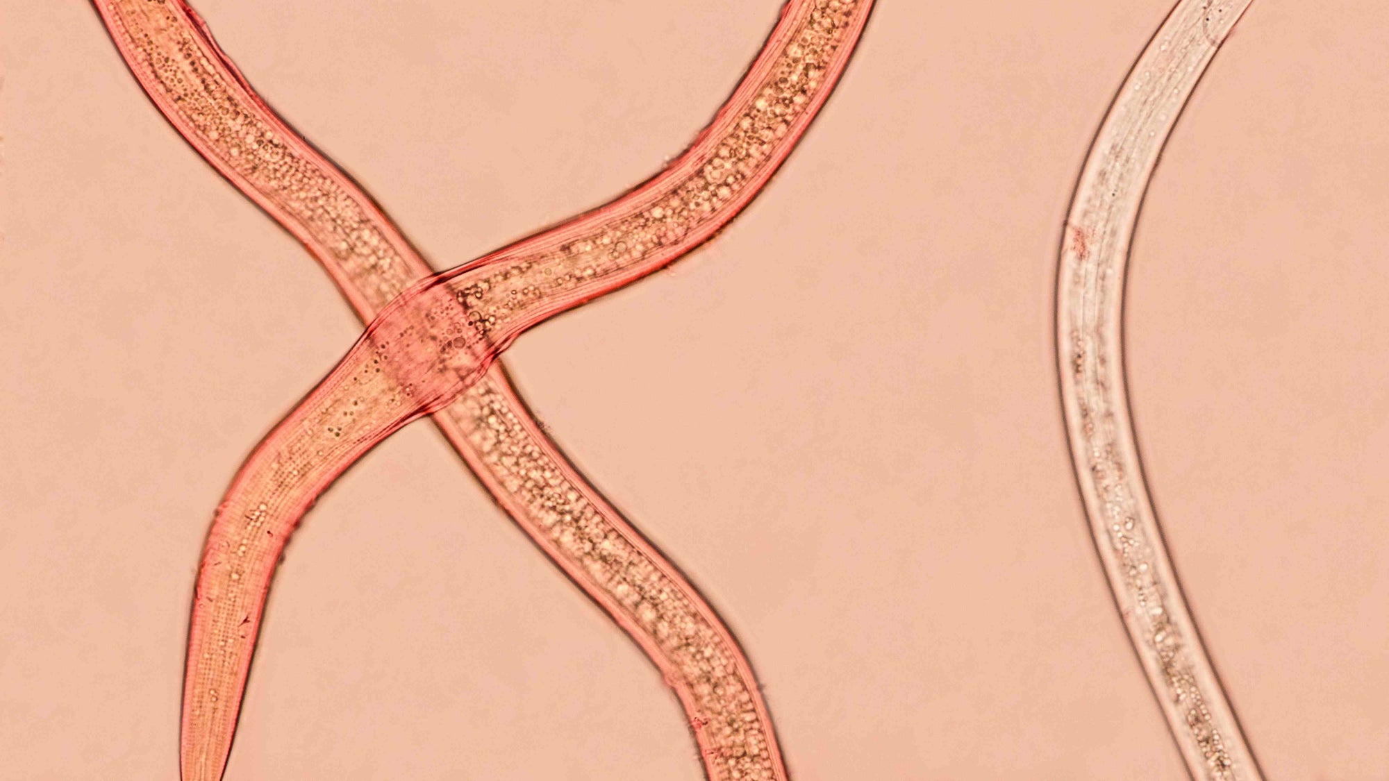 Microscopic view of a nematode under a microscope