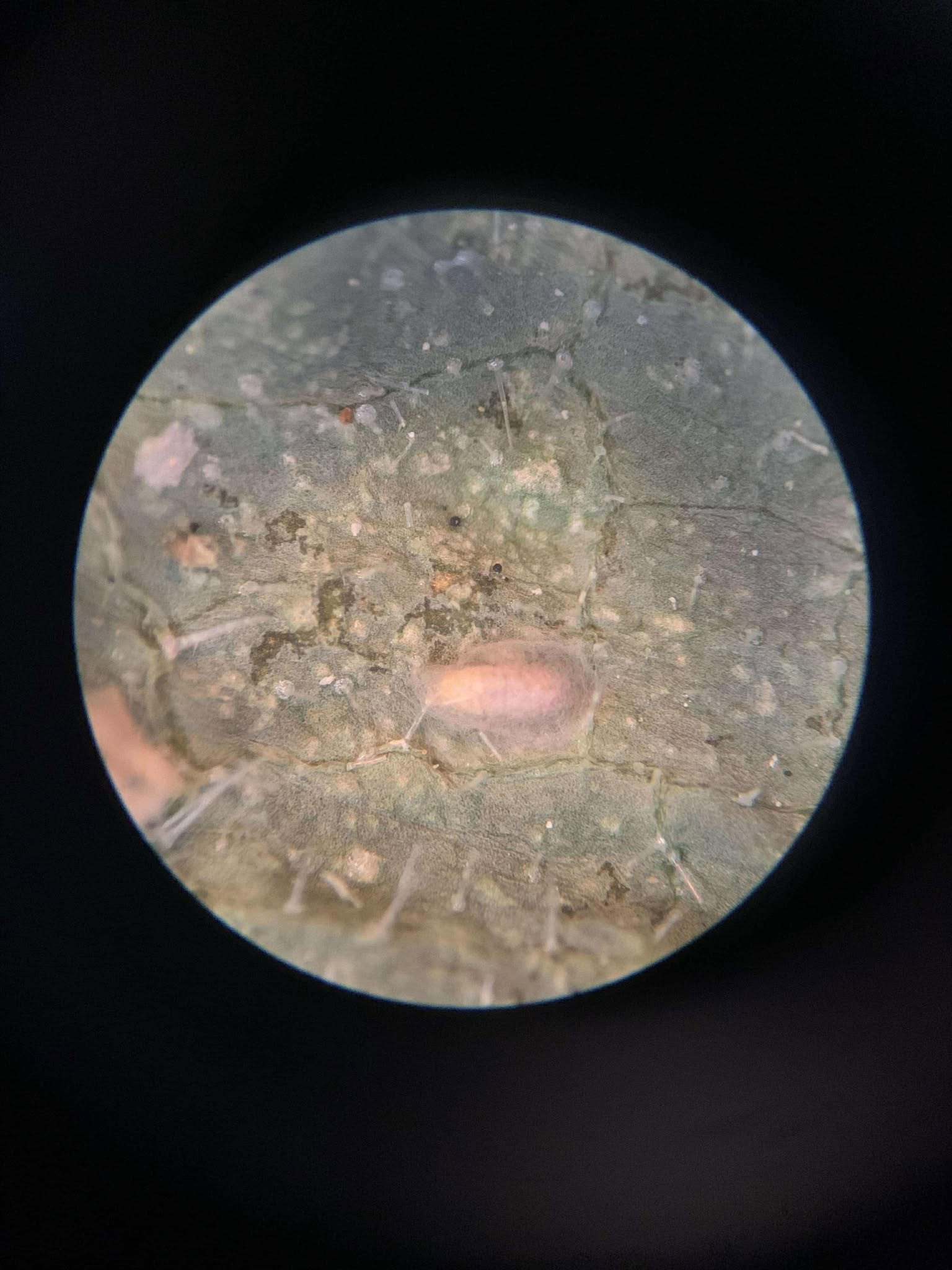 Microscopic view of a biological sample on a black background