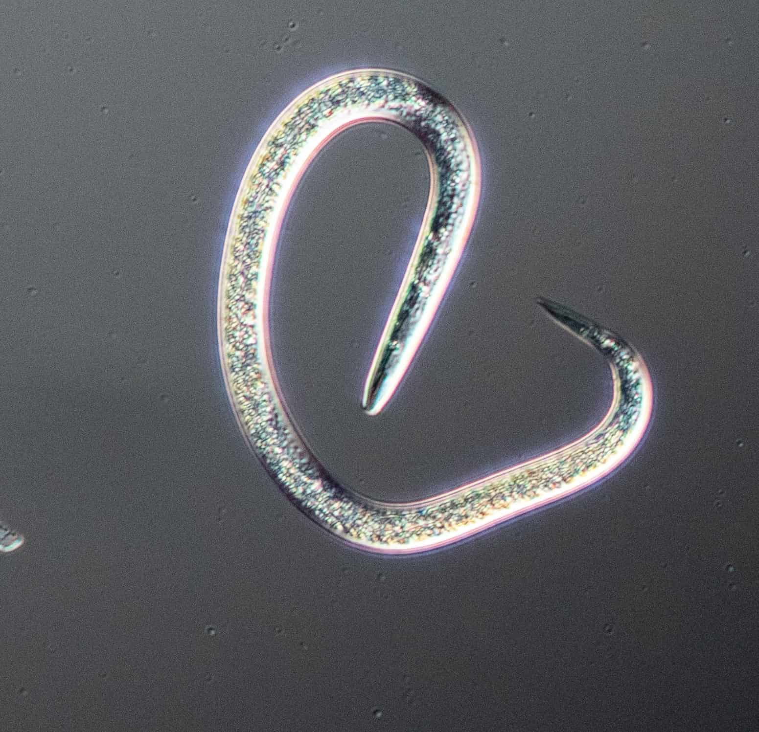 Microscopic view of a nematode on a dark background